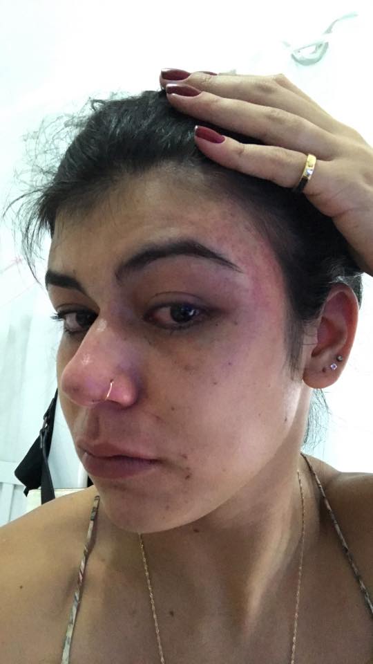Versão: Marianna Amorim divulgou imagens de suposta agressão em uma rede social (Foto: Reprodução Facebook)